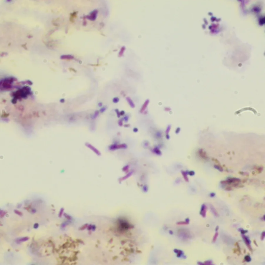 A Gram stain: violet rods and cocci scattered across a pale field.