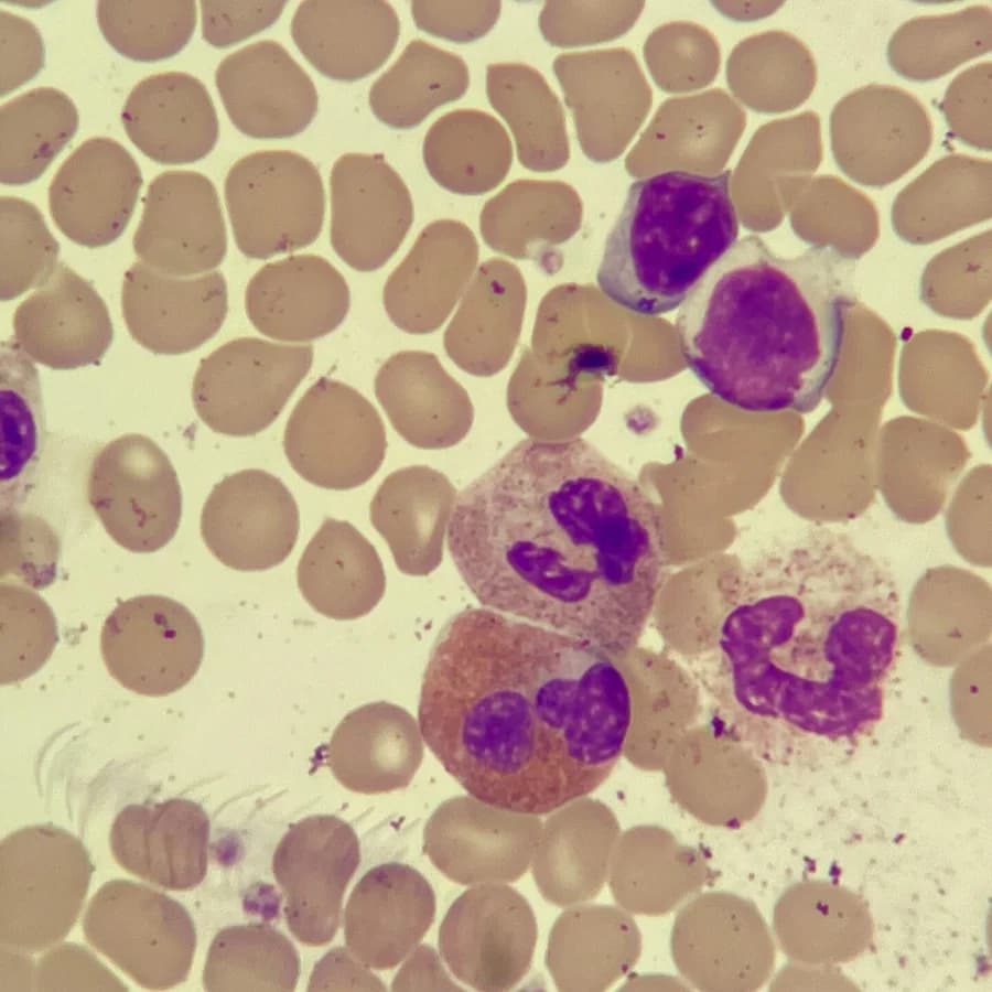 A peripheral blood smear, May-Grünwald stained.